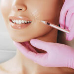 Got Unwanted Wrinkles on Face? Just How a Facial Filler Assists