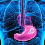 Choice Cancer Cells Treatments – Know the Other Solutions Available to You